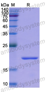 Recombinant Human DNAJC4 Protein, N-His