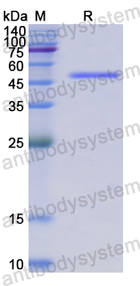 Recombinant Human SLC40A1 Protein, N-GST