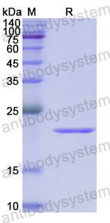 Recombinant Human IL1RAPL2 Protein, N-His