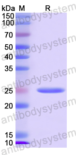 Recombinant Human FGF20 Protein, N-His