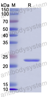 Recombinant Human CD354/TREM1 Protein, N-His