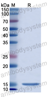 Recombinant Human KCNK9 Protein, N-His