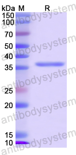 Recombinant Human CD77/A4GALT Protein, N-His