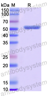 Recombinant Human ACP6 Protein, N-His