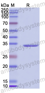 Recombinant Human SPINK5 Protein, N-His