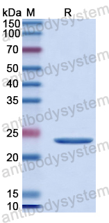 Recombinant Human A1CF Protein, N-His