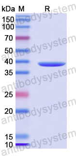 Recombinant Human TRPV5 Protein, N-His