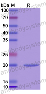 Recombinant Human CYLD Protein, N-His