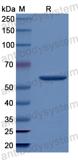 Recombinant Human DLL4 Protein, N-His