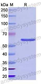 Recombinant Human CYP26B1 Protein, N-His