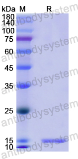 Recombinant Human PDGFC Protein, N-His