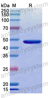 Recombinant Human SIRT7 Protein, N-His