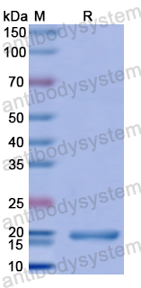 Recombinant Human DISC1 Protein, N-His