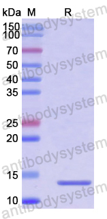 Recombinant Human CCL28/MEC Protein, N-His