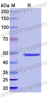 Recombinant Human DROSHA Protein, N-GST