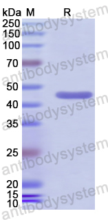 Recombinant Human TMPRSS4 Protein, N-His