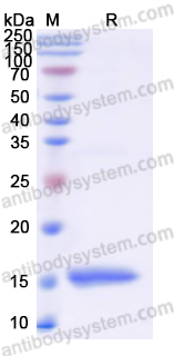 Recombinant Human PHPT1 Protein, N-His