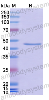 Recombinant Human GKN1 Protein, N-GST