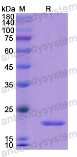 Recombinant Human FGF21 Protein, N-His