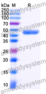 Recombinant Human FGF21 Protein, C-HSA-His