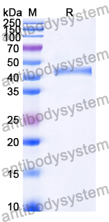 Recombinant Human FGF21 Protein, N-His-SUMO