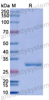 Recombinant Human CISH Protein, N-His