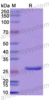 Recombinant Human TREX1 Protein, N-His