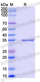 Recombinant Human TREX1 Protein, N-His-SUMO