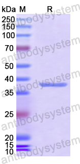 Recombinant Human ATG3 Protein, N-His