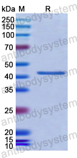 Recombinant Human HIF1AN Protein, N-His