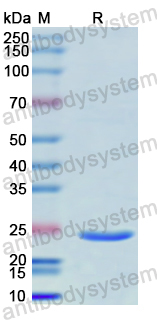 Recombinant Human IRAK4 Protein, N-His