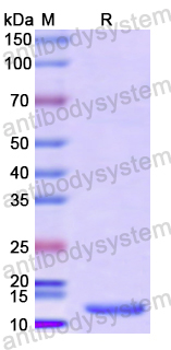 Recombinant Human LYAR Protein, N-His