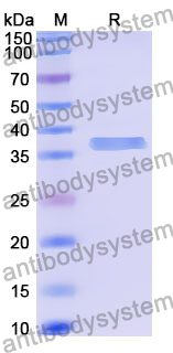 Recombinant Human LYAR Protein, N-GST & C-His