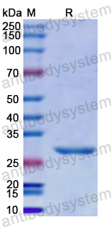Recombinant Human SPHK1 Protein, N-His