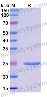 Recombinant Human UGGT2 Protein, N-His