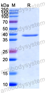 Recombinant Human UGGT1 Protein, N-His