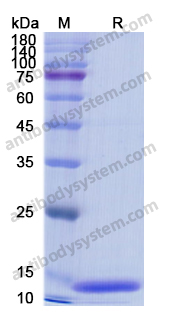 Recombinant Human IL20 Protein, N-His