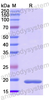 Recombinant Human TREM2 Protein, N-His