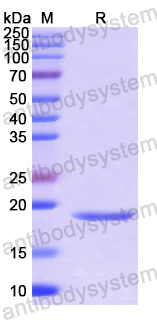 Recombinant Human TREM2 Protein, N-His