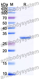 Recombinant Human TREM2 Protein, N-His-SUMO