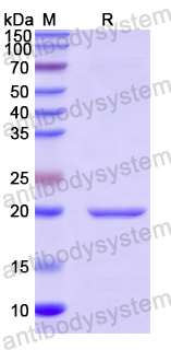 Recombinant Human IL36B/IL-1F8 Protein, N-His