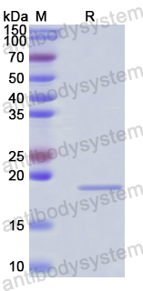 Recombinant Human IL36G/IL-1F9 Protein, N-His