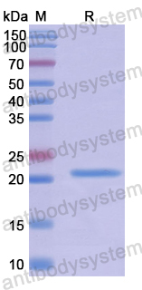 Recombinant Human IL17C Protein, N-His