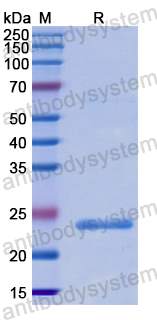 Recombinant Human HMG20B Protein, N-His