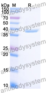 Recombinant Human CD172g/SIRPG Protein, N-His