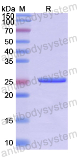 Recombinant Human PIM2 Protein, N-His