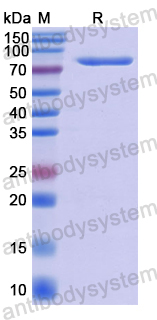 Recombinant Human SEMA5B Protein, N-His