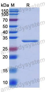 Recombinant Human CD315/PTGFRN Protein, N-His