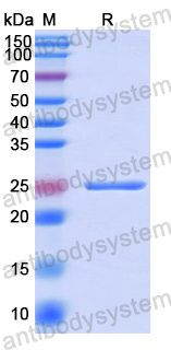 Recombinant Human ADAMTS9 Protein, N-His