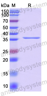 Recombinant Human CD57/B3GAT1 Protein, N-His